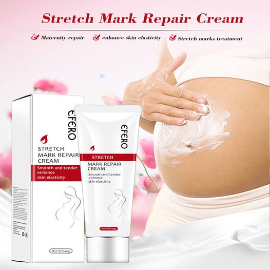 Stretch Mark Repair cream